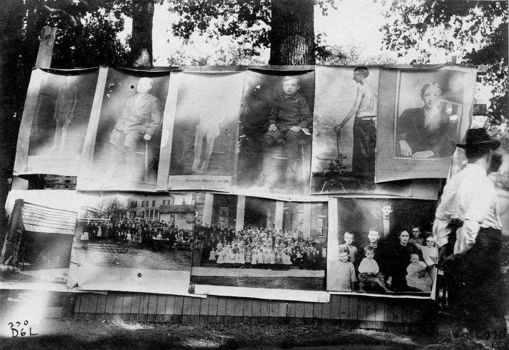 Display of large prints of individuals from Warren County demonstrating before and after images of children, two larger groups of people, a small home, and a family.